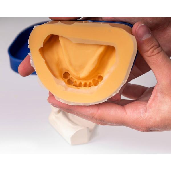 Interduplicast 1+1 kg