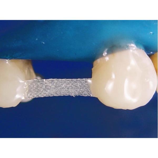 Dentapreg Bridge PFM 3,0x0,3mm 3 ks